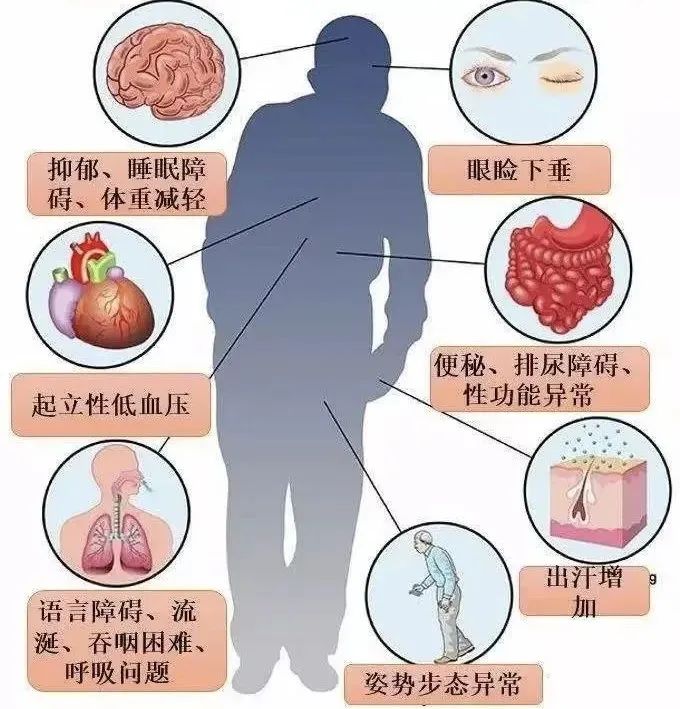 零距离健康预约 | 老年人常见脑部疾病的规范治疗 西安医学院第一附属